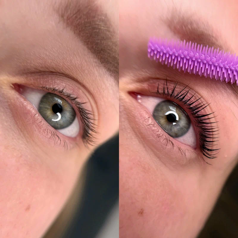 До процедуры